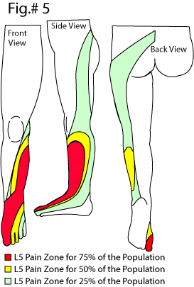 L5 dermatome