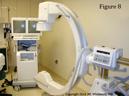 fluoroscopy machine