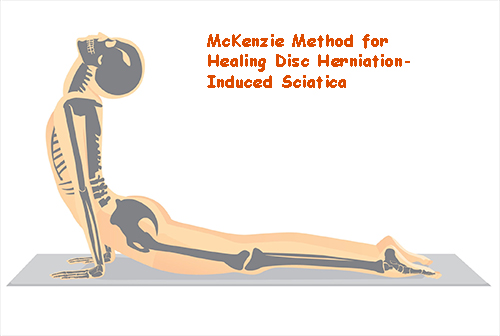 McKenzie-Stretch