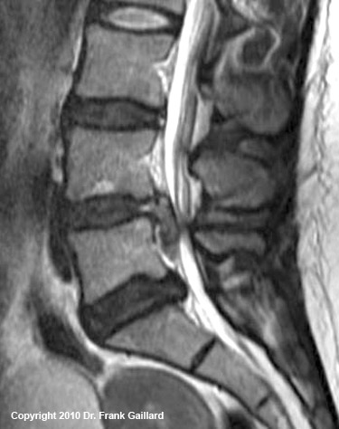 TSE/FSE - Questions and Answers ​in MRI